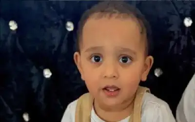 رضيع يفقد لسانه ويتعرض لحروق بعد