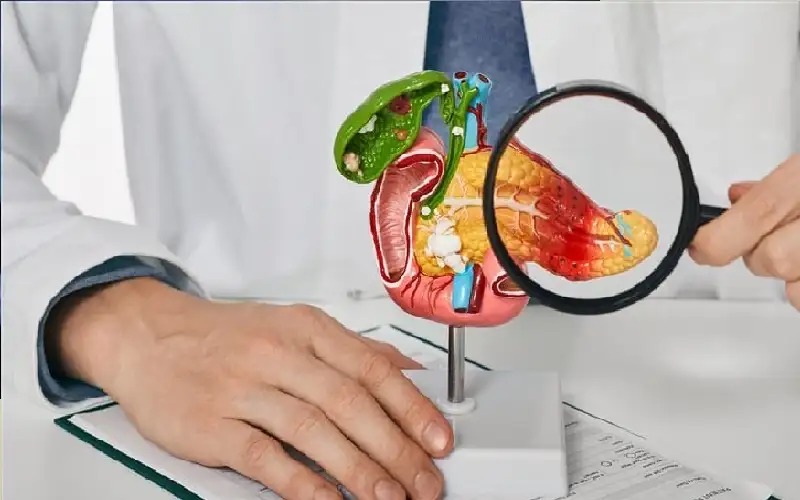 عادات يومية تؤدي إلى التهاب البنكرياس