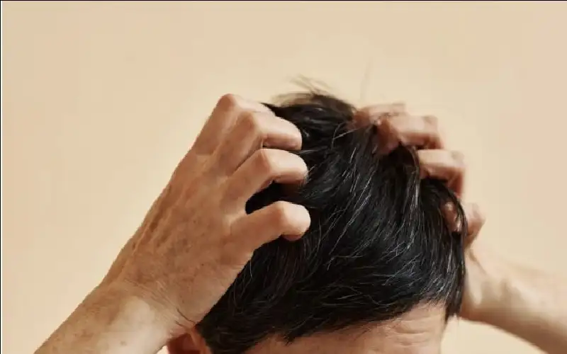 أسباب حكة الجلد وفروة الرأس وطرق