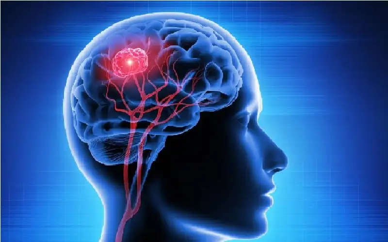 بعد 70 عاما… دواء الحمل الشهير