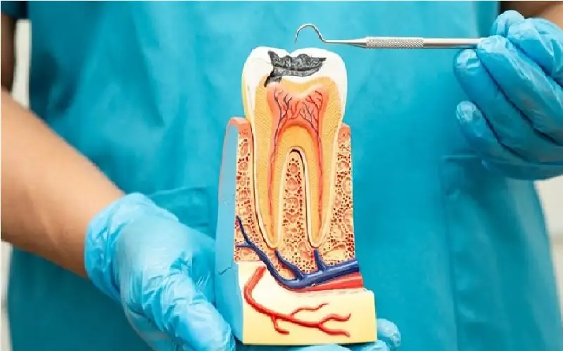 دراسة تكشف الصلة بين علاج قناة