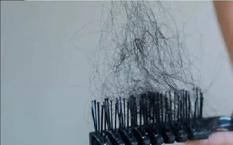 دراسة تكشف كيف يسبب التوتر تساقط