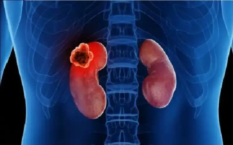 لا تتجاهلها.. 6 إشارات مبكرة تكشف