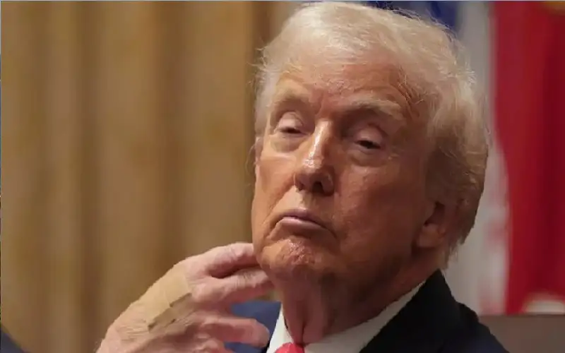 ترامب يظهر بضمادة على معصمه أثناء