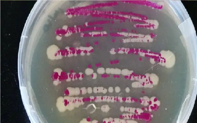 أغرب طريقة للبقاء.. بكتيريا تتظاهر بالموت