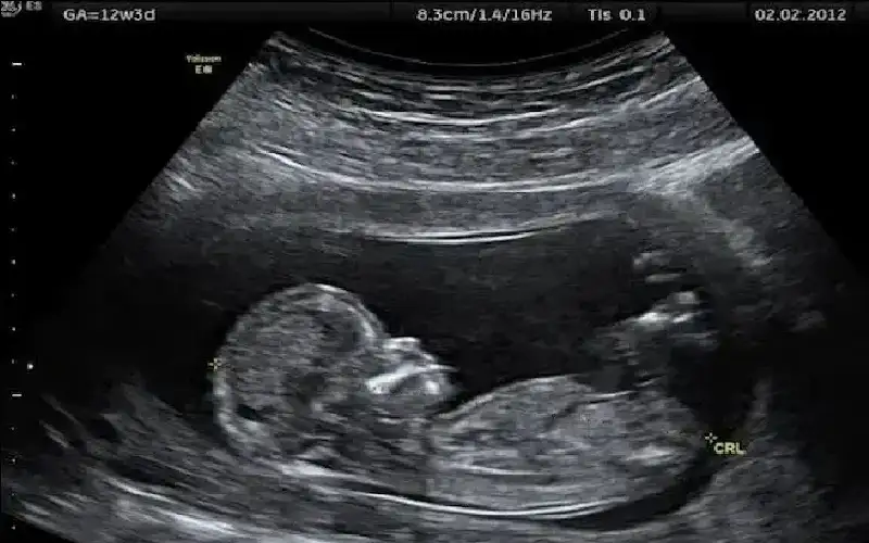 4 خرافات شائعة حول فحوصات ما