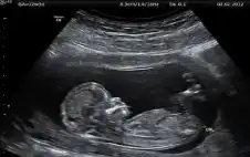 4 خرافات شائعة حول فحوصات ما