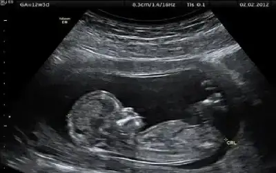 36.4 % ارتفاع تدفقات الاستثمار الأجنبي