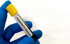 صحة ـ صحة الكلى قد تكون مفتاح الوقاية