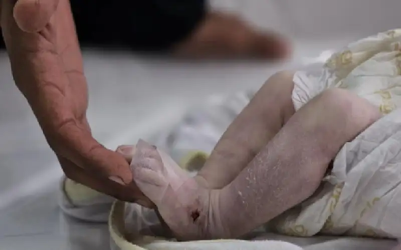 رضيعة غزية قتلها من البرد ونشرة