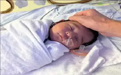 امرأة نيسان ـ حالة طبية نادرة.. جنين مكتمل النمو