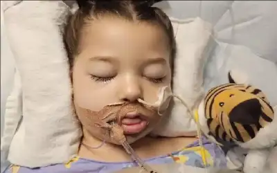 امرأة نيسان ـ من أعراض بسيطة إلى غيبوبة.. أب