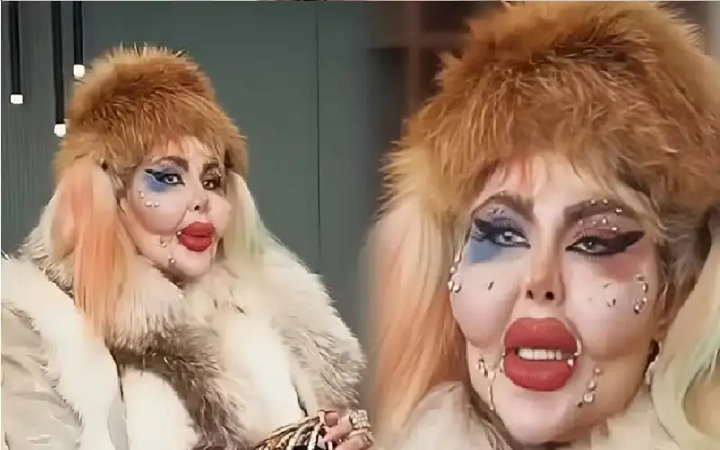 388 عملية تجميل و8 سنوات بلا