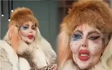 388 عملية تجميل و8 سنوات بلا