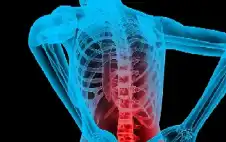 باحثون يحددون الأنشطة التي تسبب آلام