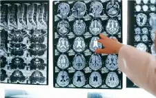 تجربة: نتائج مذهلة لمكملات غذائية في