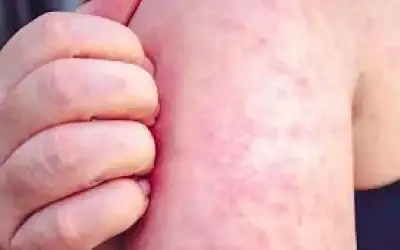 حماس: إسرائيل تمعن في حرب الإبادة