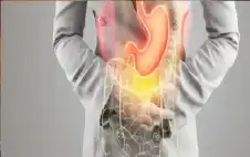 ليست مجرد حموضة.. حرقة المعدة المتكررة