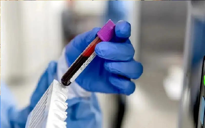 اختبار دم يحدد الأشخاص الأكثر عرضة