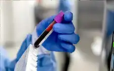 اختبار دم يحدد الأشخاص الأكثر عرضة