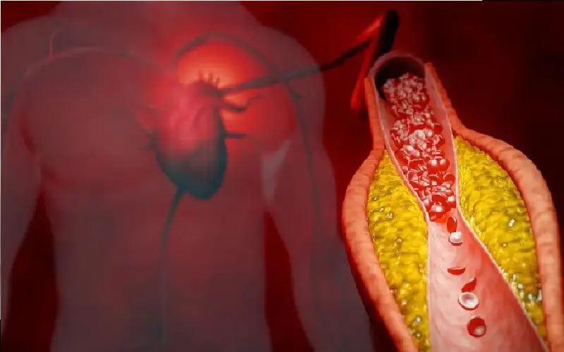 3 طرق لخفض الكوليسترول بدون أدوية