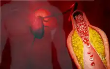 صحة ـ 3 طرق لخفض الكوليسترول بدون أدوية