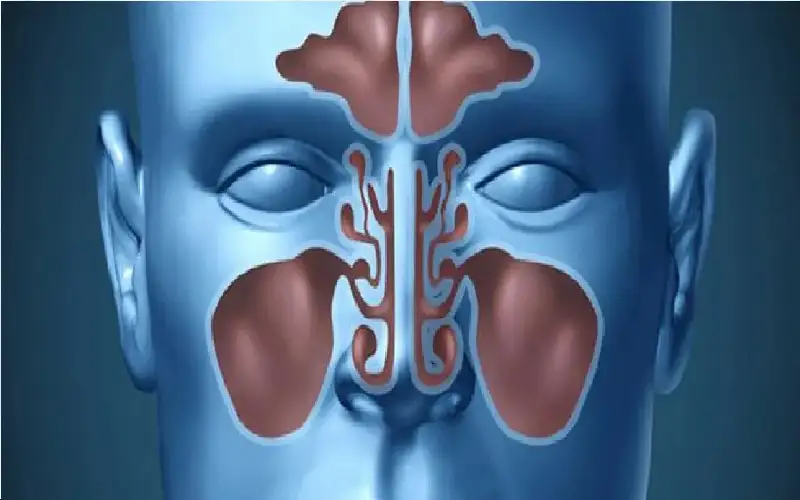 حقنة جديدة تنهي كابوس سيلان الأنف