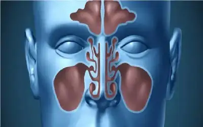 حقنة جديدة تنهي كابوس سيلان الأنف