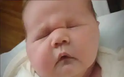 جمعية القلب الأميركية تجدد اعتماد المجلسي