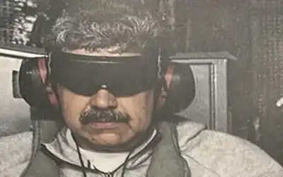 أهم 5 أسباب تؤدي إلى تساقط