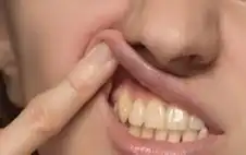 ابتكار جديد لوقاية الأسنان من التسوس