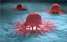 اكتشاف مقلق.. فيتامين يمنح السرطان فرصة