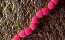 الجروح المزمنة لا تلتئم رغم المضادات