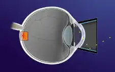 صحة ـ كيف تتسبب وسادتك في رفع ضغط