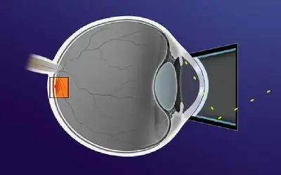 صحة ـ كيف تتسبب وسادتك في رفع ضغط