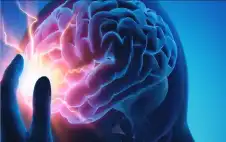 شكل صداع هبوط الضغط- أين يحدث