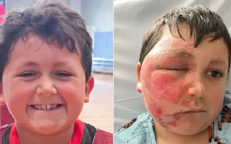 كارثة تيك توك.. صرخة أم بعد