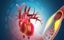 صحة ـ لغز آلام العضلات مع أدوية الكوليسترول..