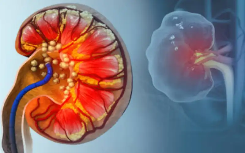 دراسة تفجر مفاجأة عن السبب الحقيقي