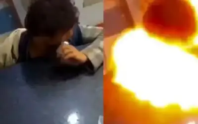 ميديا ـ مراهق يقضم بطارية هاتف فتنفجر داخل