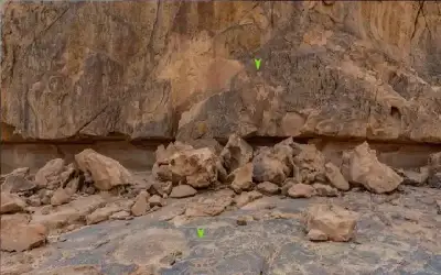 الذكاء الاصطناعي يكتب مستقبل الجراحة