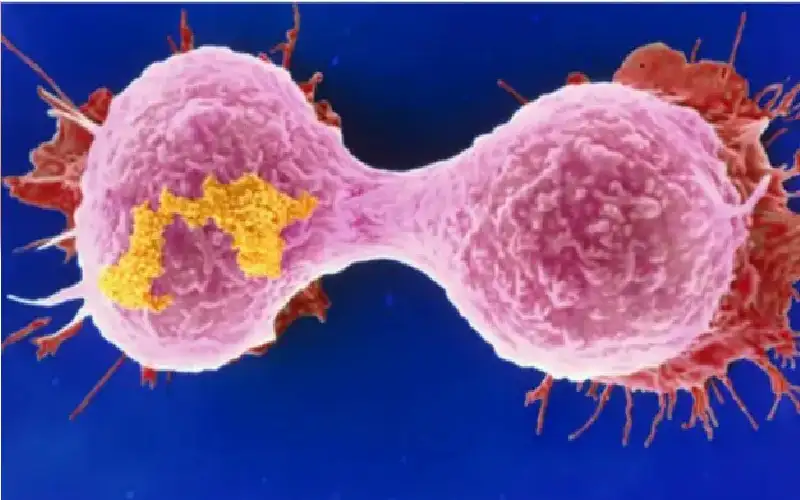 سرطان الثدي.. كيف يكتشف الذكاء الاصطناعي