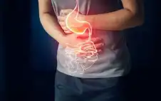 كيف تواجه حرقة المعدة وارتجاع المريء