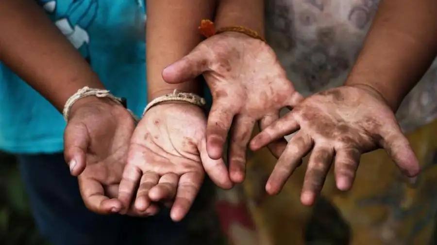 مركز حقوق الإنسان: 75 ألف طفل