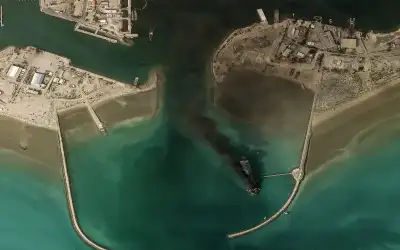 جراحة لتحويل مسار الشريان التاجي دون