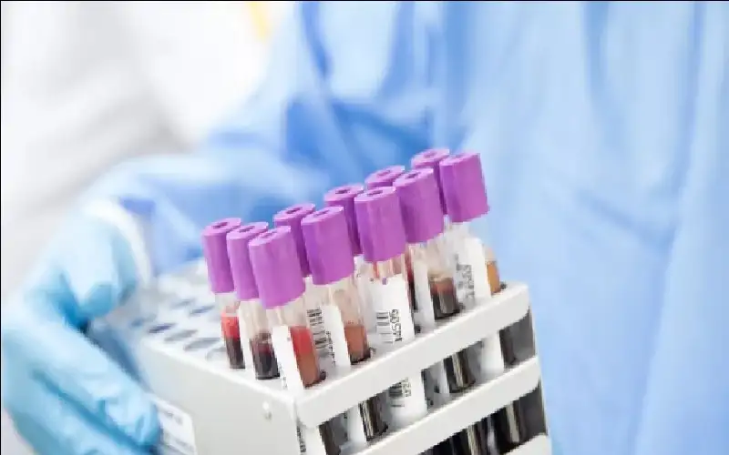 فحص دم يتنبأ بالخرف