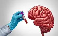 أدوية شائعة لهشاشة العظام تحمي الدماغ