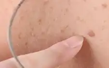 روسيا تبدأ استخدام أول لقاح لعلاج