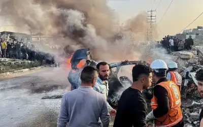 ما الذي قد يحصل إذا حلقنا