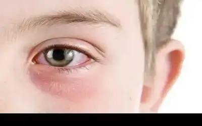 جرش: إنشاء طريق بديل في سوف